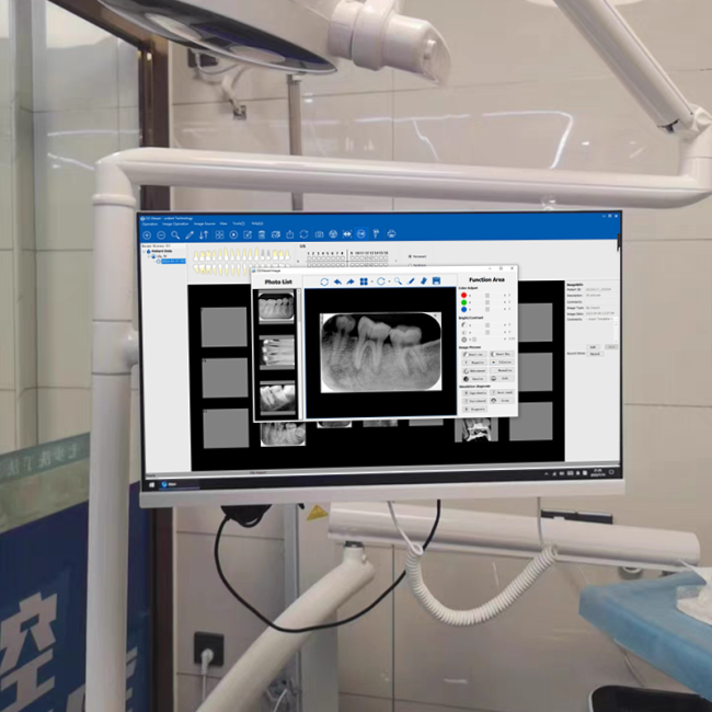 Dentalisches WLAN All-in-One-Intraorale Camera mit 24-Zoll-Touchscreen